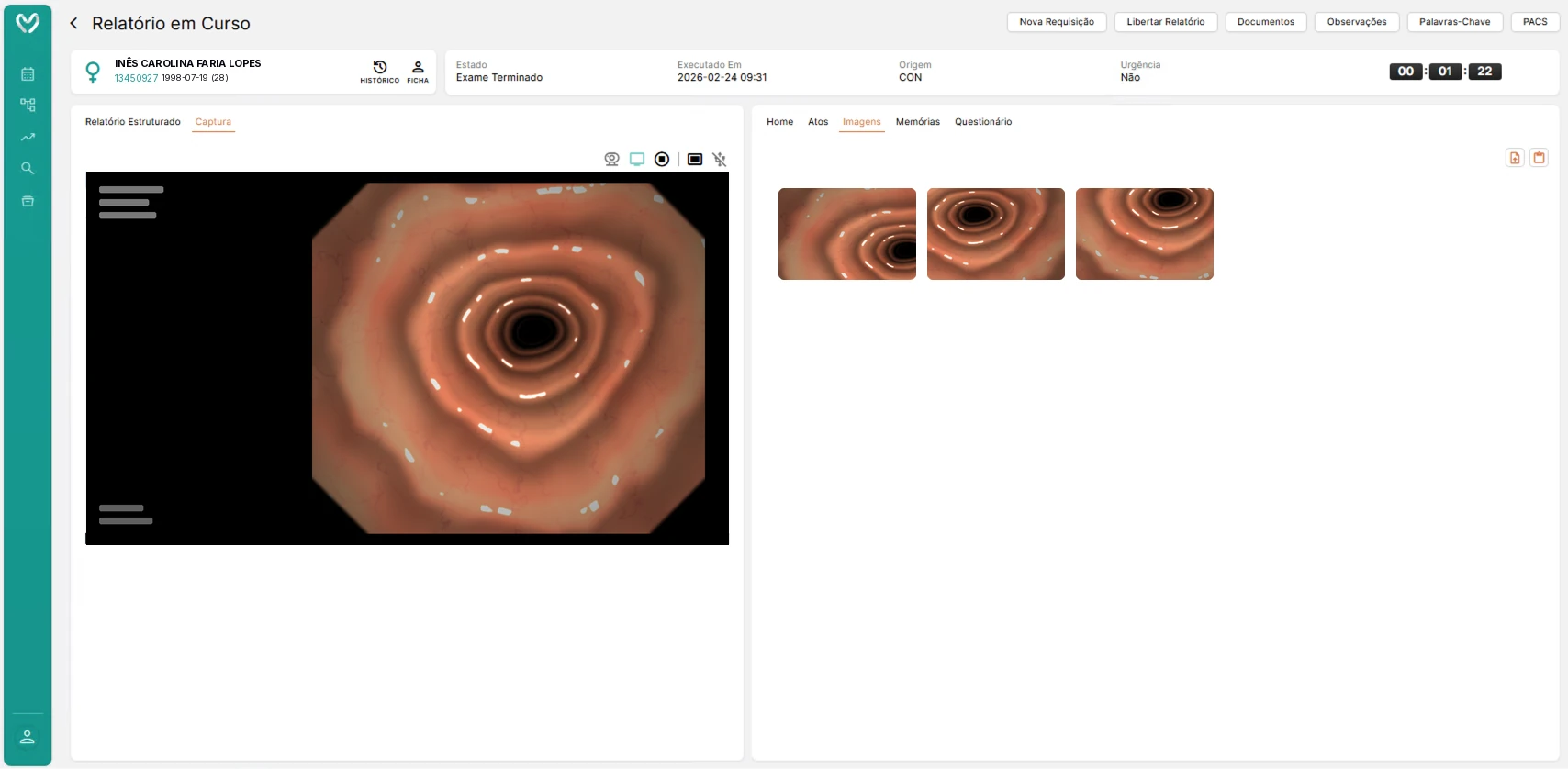 Report in progress with image capture from the endoscope video and the captured frames